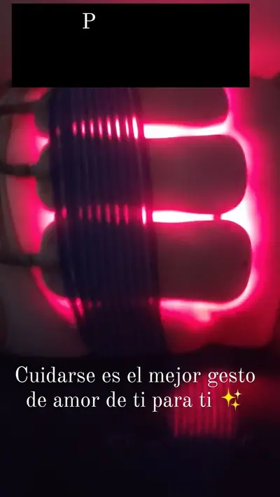 Sesión de depilación láser