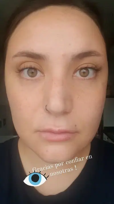 Tratamiento de piel