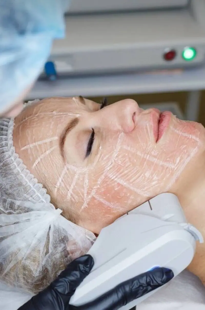 Tratamiento facial